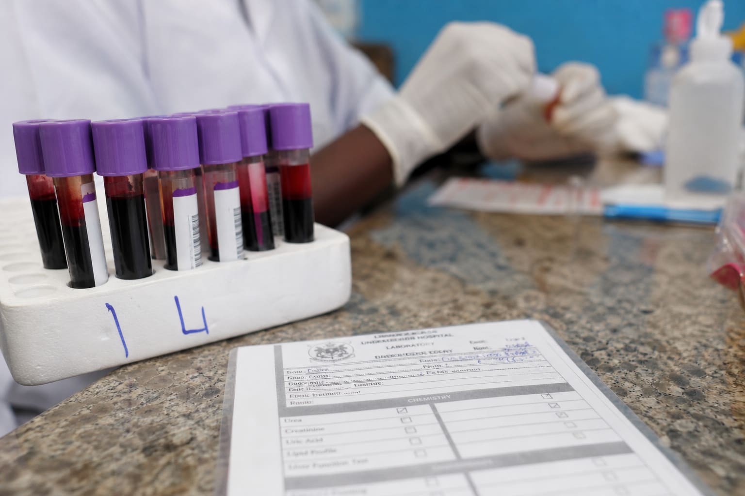 How Much Does a Full Blood Test Cost in Ghana? 2026 Price Guide